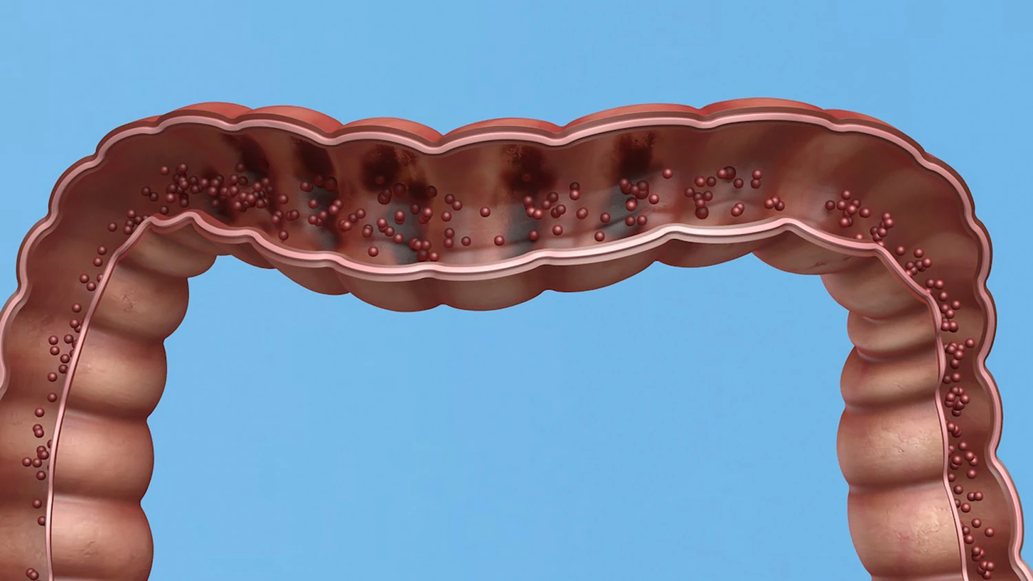 Enterotoxin demonstration internal organs anatomy gastrointestinal 3D Model .c4d .max .obj .3ds .fbx .stl .blend 