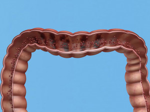 Enterotoxin demonstration internal organs anatomy gastrointestinal Model 3D