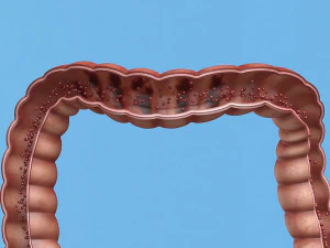 Enterotoxin demonstration internal organs anatomy gastrointestinal 3D Model