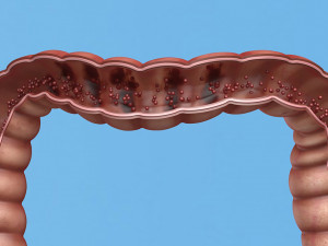 Enterotoxin demonstration internal organs anatomy gastrointestinal Model 3D