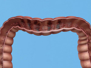 Enterotoxin demonstration internal organs anatomy gastrointestinal Model 3D