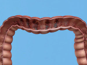 Enterotoxin demonstration internal organs anatomy gastrointestinal 3D Model