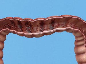 Enterotoxin demonstration internal organs anatomy gastrointestinal Model 3D