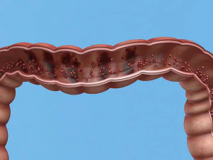 Enterotoxin demonstration internal organs anatomy gastrointestinal 3D Model