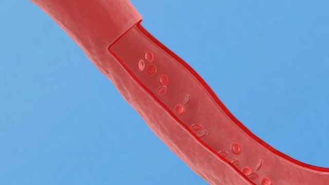 Blood vessel red human system artery health vessels Modelo 3D .c4d .max .obj .3ds .fbx .stl .blend 