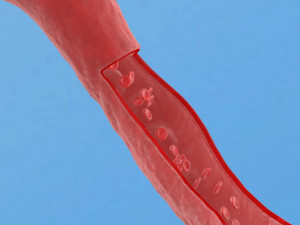 Blood vessel red human system artery health vessels Modelo 3D