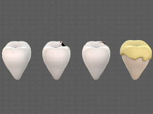 Teeth Cartoon V03 3Dモデル