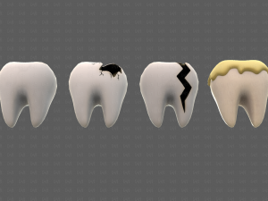 Teeth Cartoon V03 3Dモデル