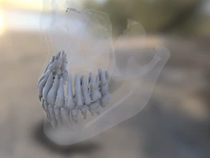 model teeth with jaw and facial skeleton full quality 3D Print Model