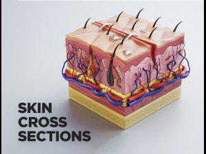 skin cross sections-damaged skin-cut skin- with 4k textures 3D Model