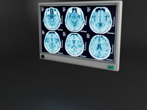 medical equipment pack Modelo 3D