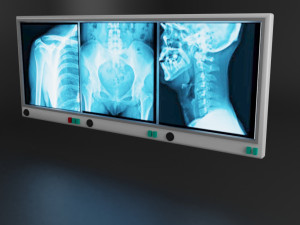 medical equipment pack Modelo 3D