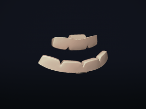 bigmouth - 3d printable model 3D 打印模型