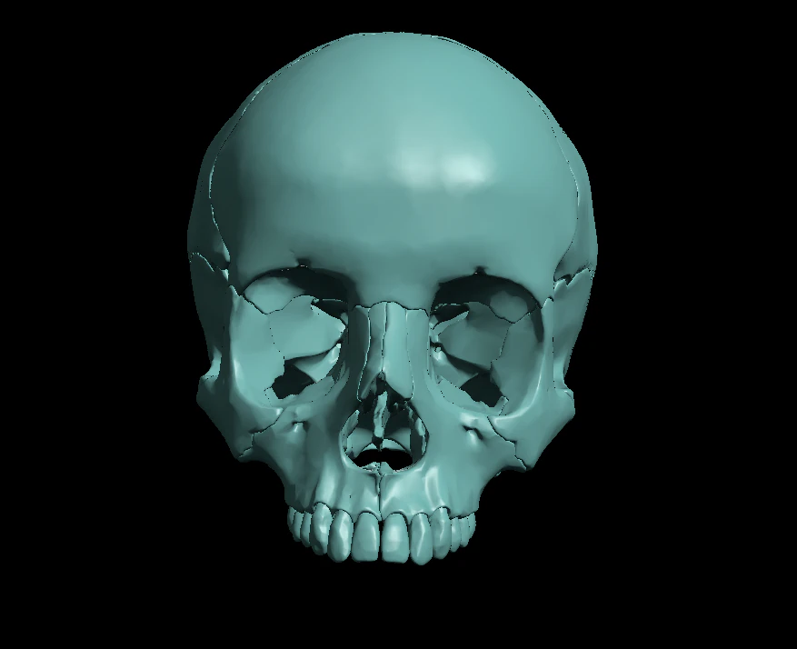 खोपड़ी खंडित 3D प्रिंट मॉडल .c4d .max .obj .3ds .fbx .stl .blend 