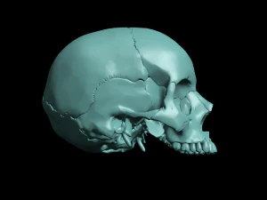 खोपड़ी खंडित 3D प्रिंट मॉडल