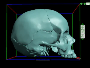 खोपड़ी खंडित 3D प्रिंट मॉडल