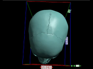 खोपड़ी खंडित 3D प्रिंट मॉडल