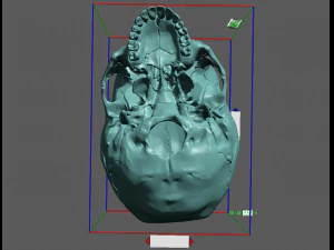 खोपड़ी खंडित 3D प्रिंट मॉडल