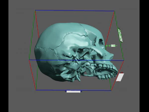 खोपड़ी खंडित 3D प्रिंट मॉडल