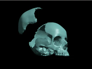 खोपड़ी खंडित 3D प्रिंट मॉडल
