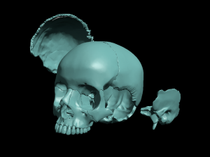 skull segmented Modelo de impresión 3D