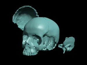 खोपड़ी खंडित 3D प्रिंट मॉडल