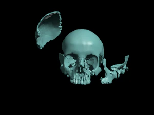 खोपड़ी खंडित 3D प्रिंट मॉडल
