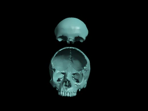 खोपड़ी खंडित 3D प्रिंट मॉडल