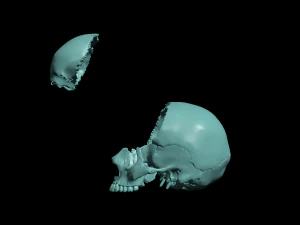 खोपड़ी खंडित 3D प्रिंट मॉडल