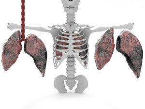 smoker lungs 3D Model