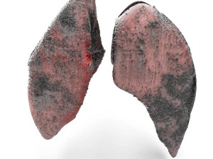 smoker lungs 3D Model