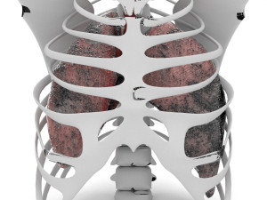 smoker lungs Modèle 3D
