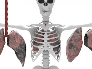 smoker lungs Modèle 3D