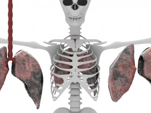 smoker lungs 3D Model