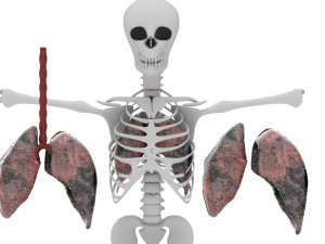 smoker lungs Modèle 3D