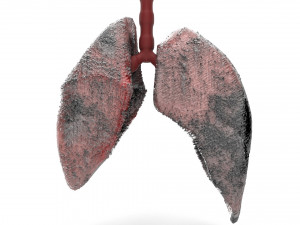 smoker lungs Modèle 3D