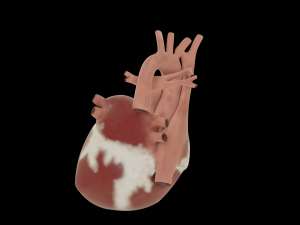 heart with cross section Model 3D