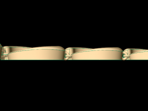 bracelet 10 Modèles 3D en vedette