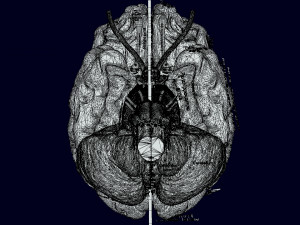 Central nervous system cortex limbic basal ganglia stem cerebel 3D 模型
