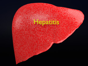 3D Alchoholic liver disease cirrhosis hepatitis fatty model Modelo 3D