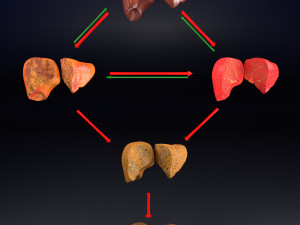 3D Alchoholic liver disease cirrhosis hepatitis fatty model Modelo 3D
