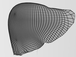 3D Alchoholic liver disease cirrhosis hepatitis fatty model Modelo 3D