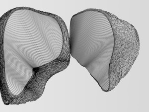 3D Alchoholic liver disease cirrhosis hepatitis fatty model Modelo 3D