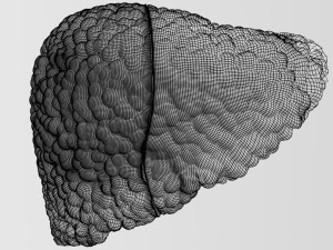 3D Alchoholic liver disease cirrhosis hepatitis fatty model Modelo 3D
