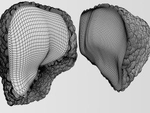 3D Alchoholic liver disease cirrhosis hepatitis fatty model Modelo 3D