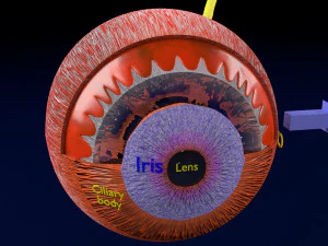 Age-related macular degeneration AMD ARMD detailed labelled animated model 3D 3D Model