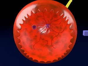 Age-related macular degeneration AMD ARMD detailed labelled animated model 3D 3D Model