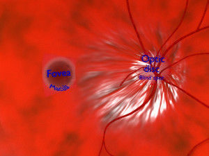 Age-related macular degeneration AMD ARMD detailed labelled animated model 3D Modello 3D