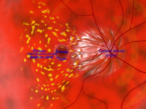 Age-related macular degeneration AMD ARMD detailed labelled animated model 3D Modello 3D