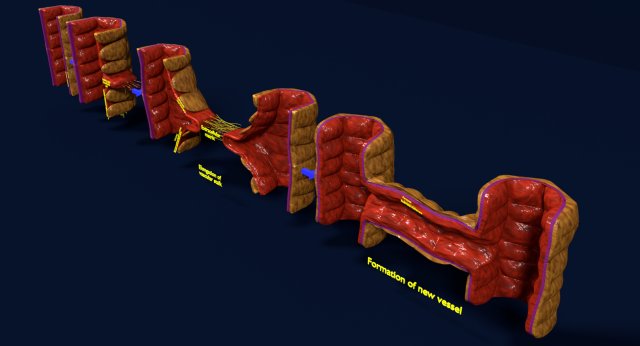 3D Angiogenesis Model 3D .c4d .max .obj .3ds .fbx .stl .blend 